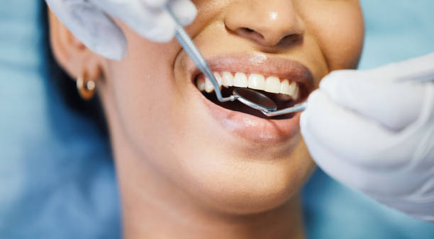 Best Emergency Root Canal Treatment in Rigby, ID